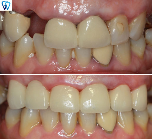 CEREC Dentist Trumbull