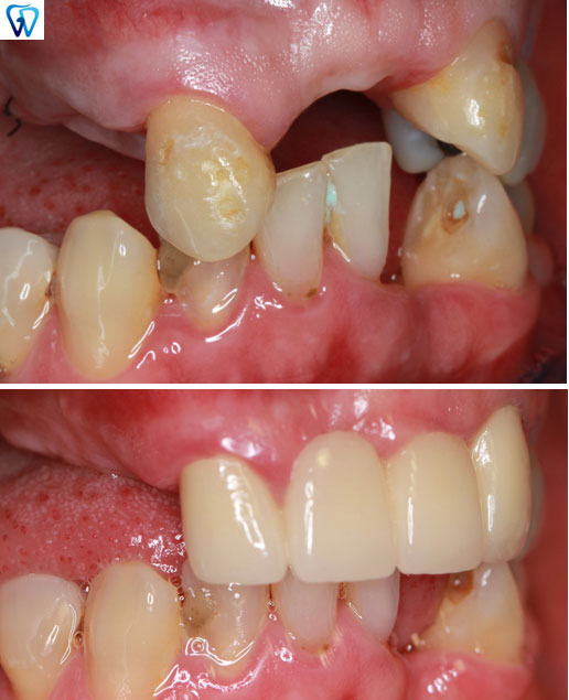 Emergency Dentist Trumbull