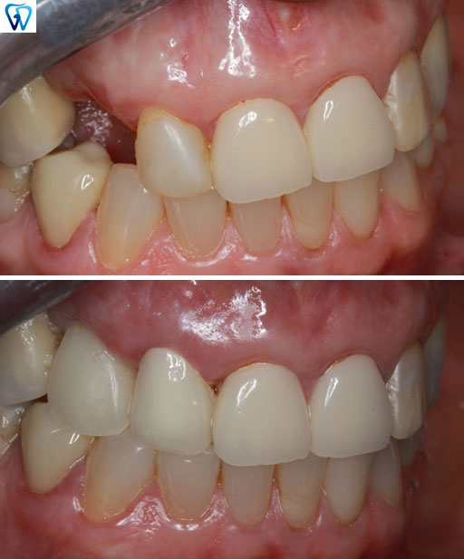 Family Dentist in Trumbull
