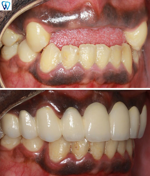 Emergency Dentist Trumbull