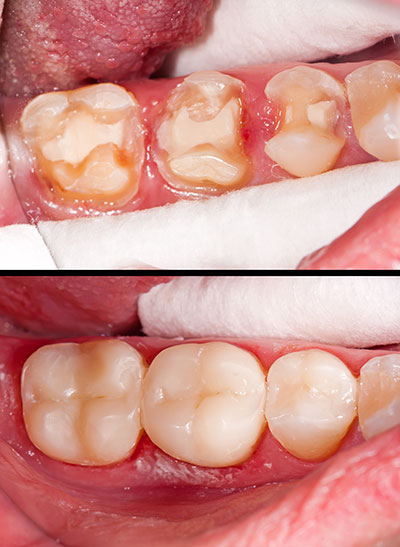 GD Dentistry | Oral Exams, Implant Dentistry and Ceramic Crowns