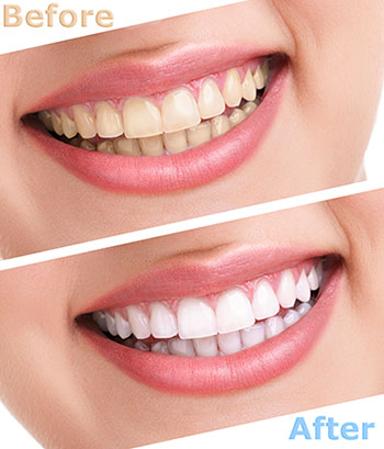 GD Dentistry | Dental Fillings, Root Canals and Implant Restorations