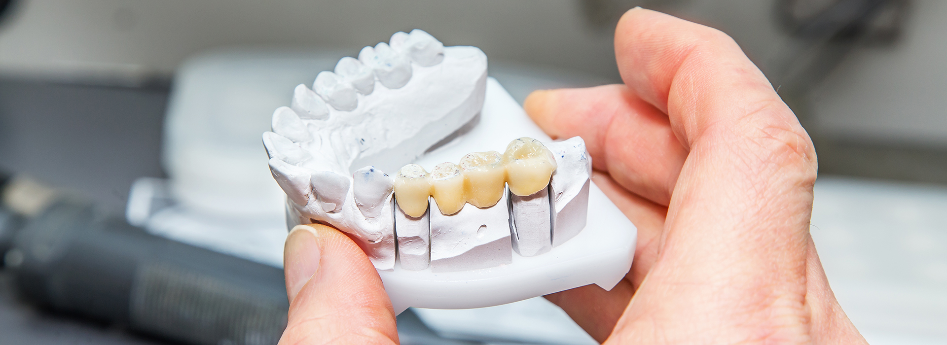 GD Dentistry | Teeth Whitening, Oral Exams and Bone Graft