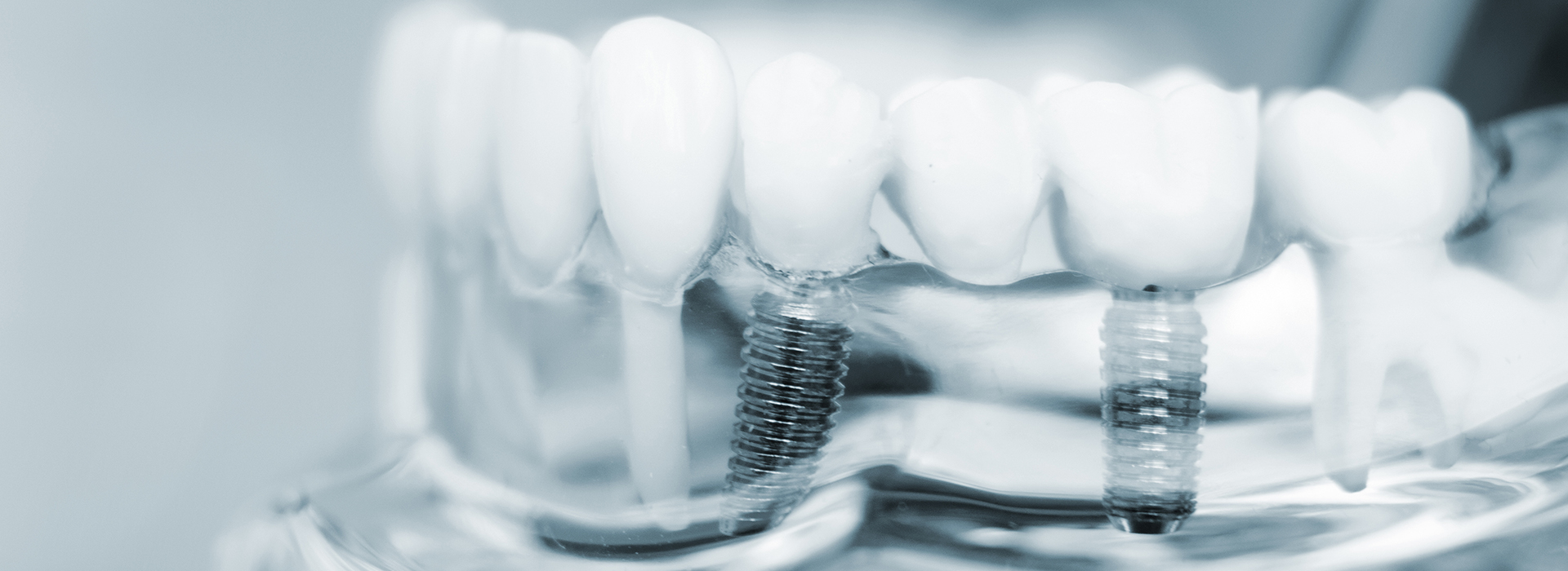 GD Dentistry | Dentures, Dental Bridges and Periodontal Treatment