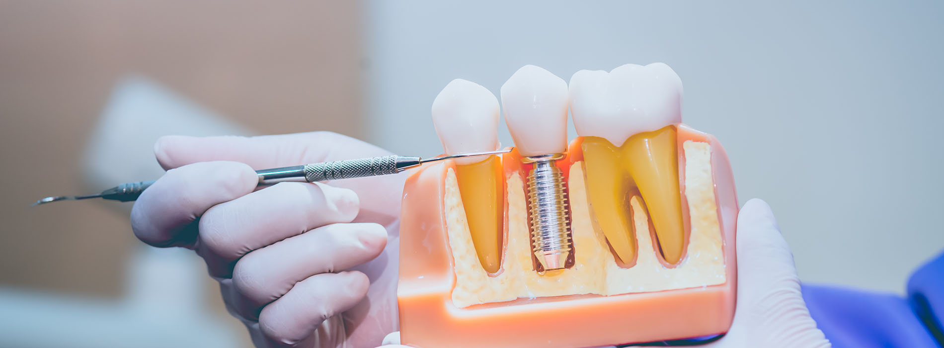 GD Dentistry | Sedation Dentistry, Night Guards and Veneers